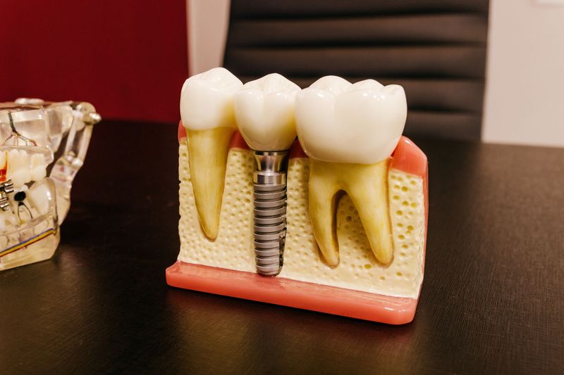 Tooth model with roots shown in a gum and bone section