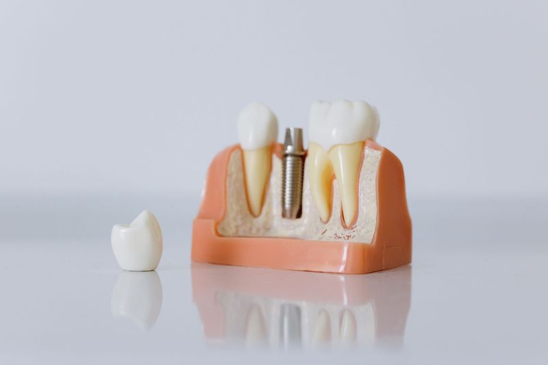 Dental implant model beside a loose crown on a white surface