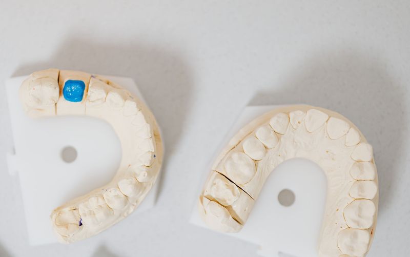 Plaster tooth cast models on a white surface